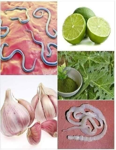 9 façons de grand-mère pour se débarrasser des vers intestinaux (rapide et efficace).