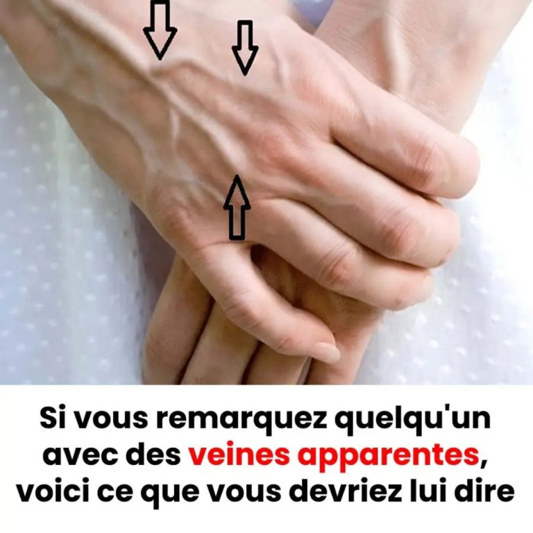 Les mystères des veines visibles : ce que votre peau révèle de votre santé