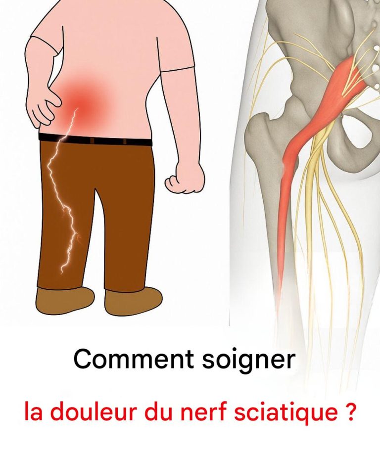 3 exercices simples pour soulager la douleur