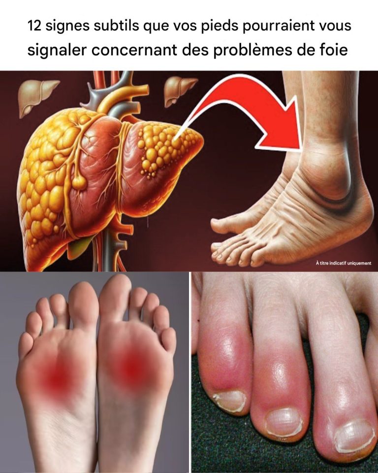 12 symptômes au niveau des pieds pouvant indiquer un problème hépatique