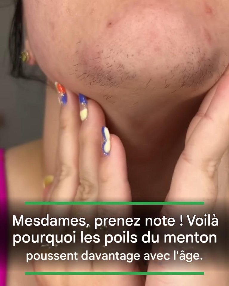 Mesdames, prenez note ! Voilà pourquoi les poils du menton poussent davantage avec l'âge.