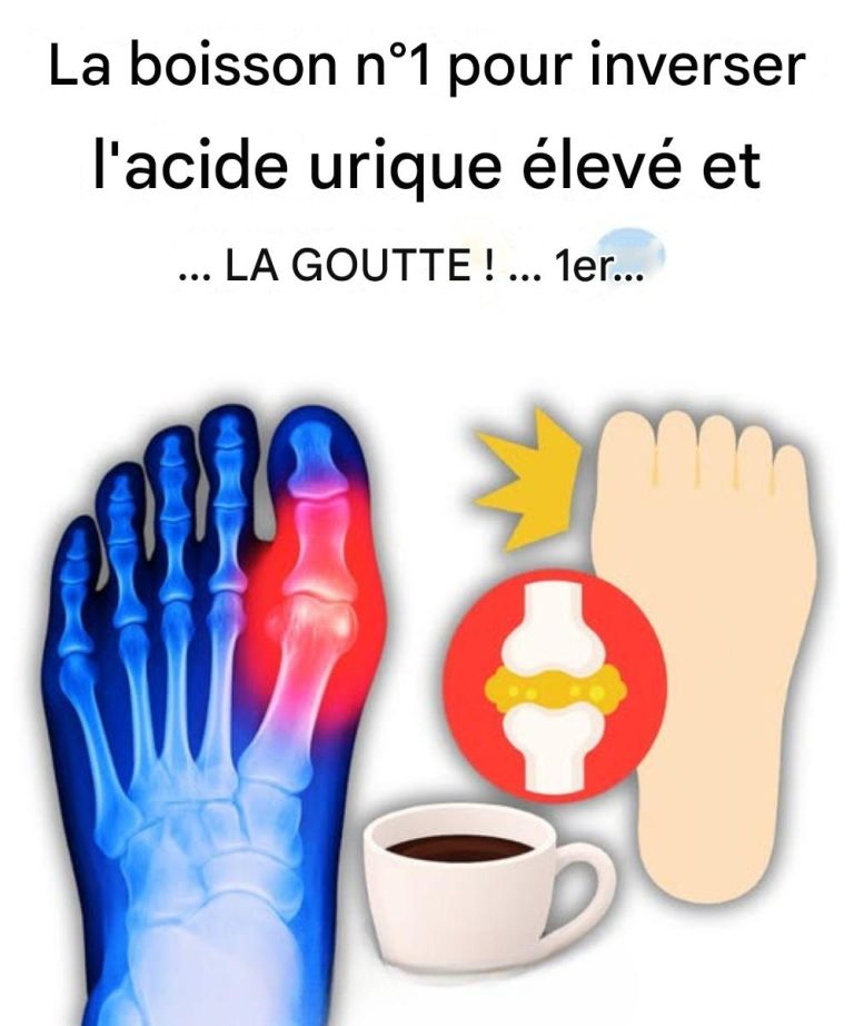 « Mon gros orteil était en feu… Jusqu’à ce que je découvre ces 5 boissons qui éliminent l’acide urique naturellement ! »