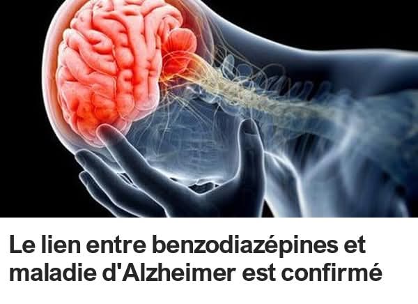 Le lien entre benzodiazépines et maladie d’Alzheimer est confirmé