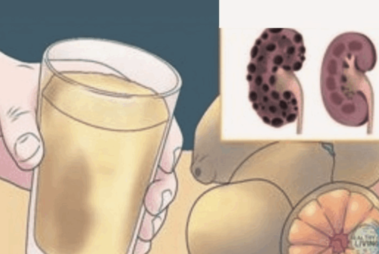 8 habitudes quotidiennes qui abîment vos reins