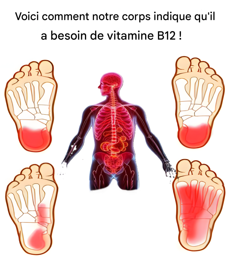 Carence en vitamine B12 : causes, symptômes et rôle essentiel