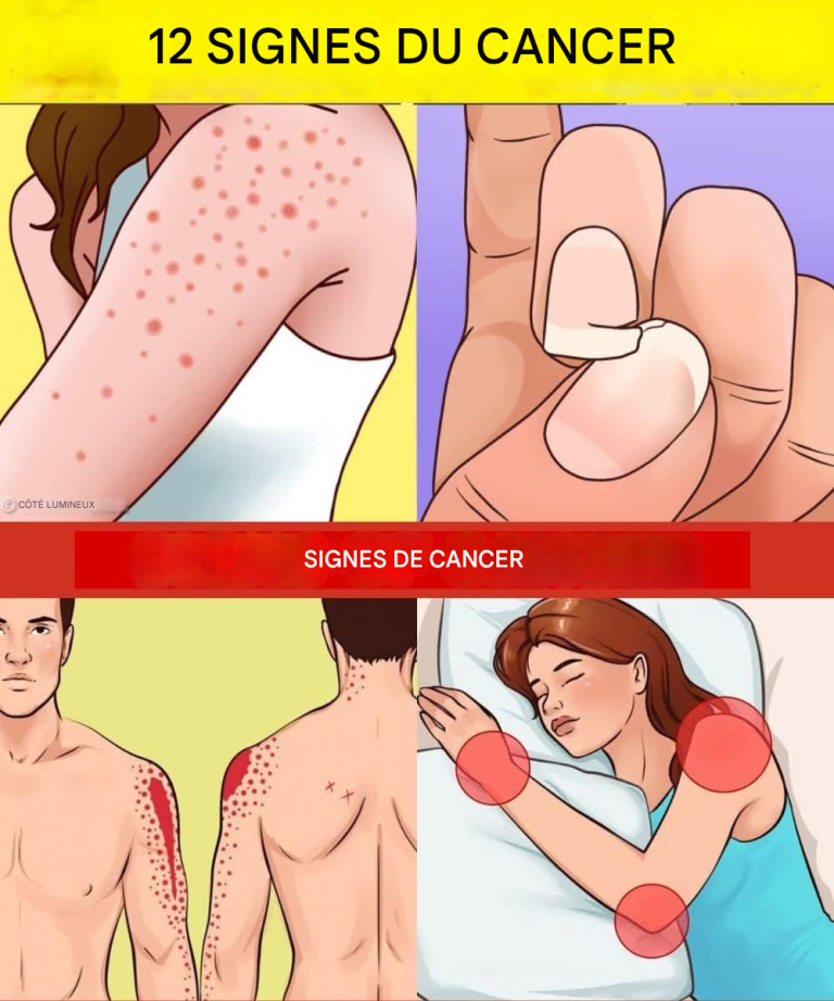 12 signes précoces possibles du cancer à ne pas ignorer